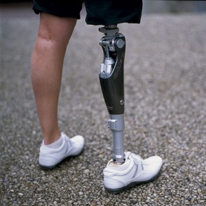 Prosthetics - BIODESIGN PROSTHETICS & ORTHOTICS